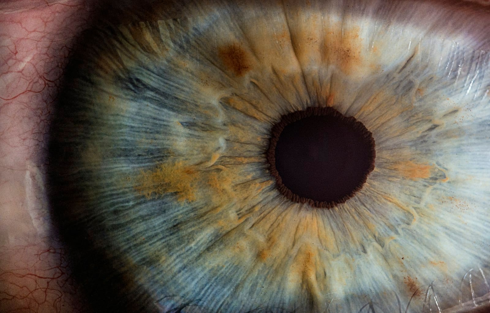 Macro photograph of a human eye — conditions reference header.